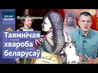 "Каўтун у валасах": самае беларускае захворванне і яго сапраўдная прычына / Вусы Скарыны cover